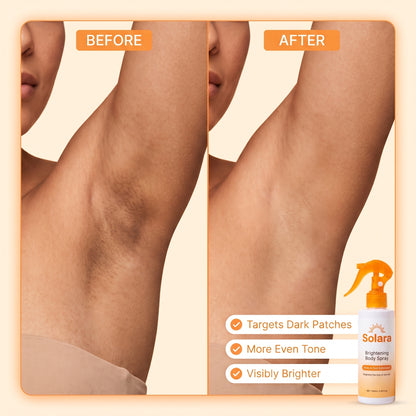 Solara before and after: dark underarm patch becomes more even and brighter