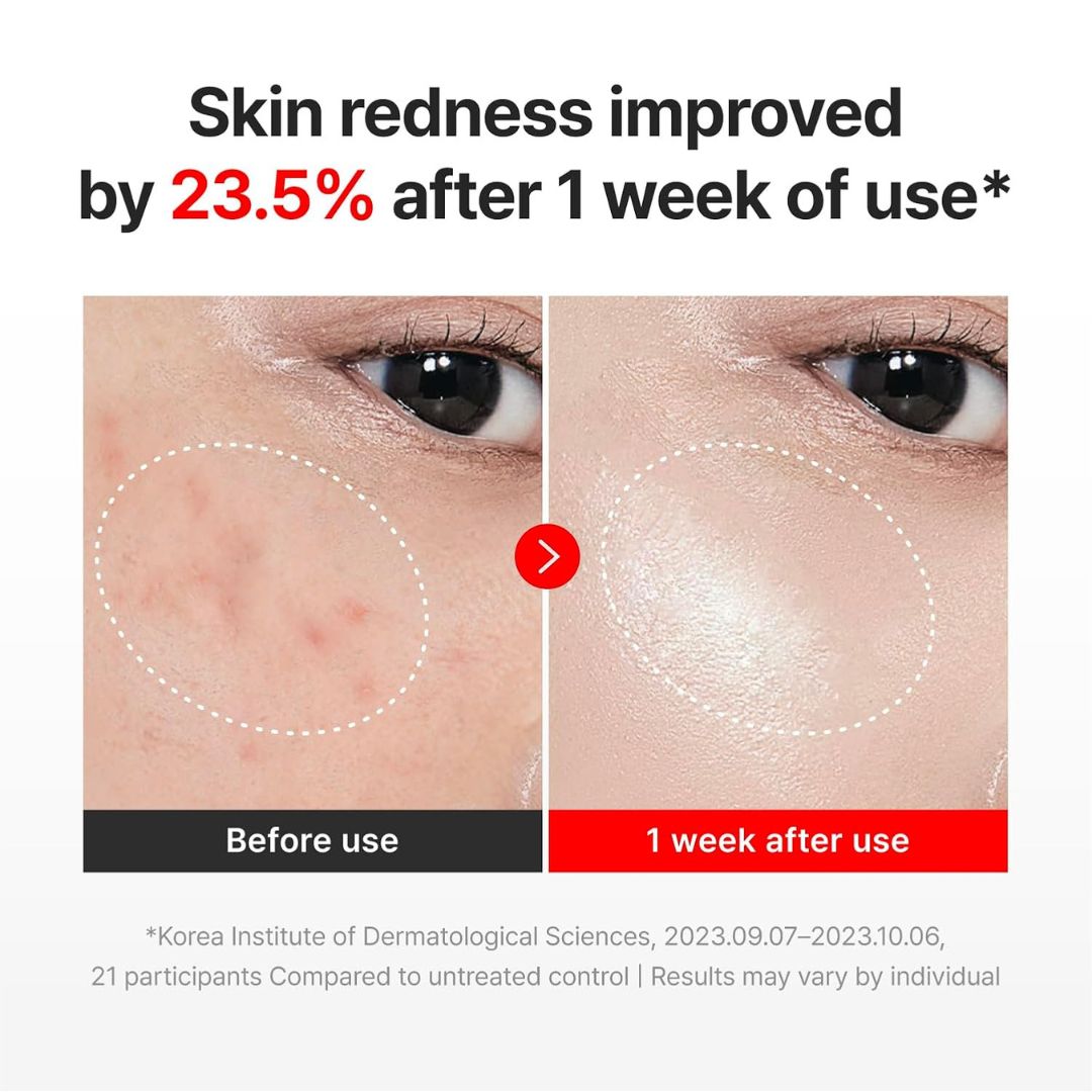 CentellaLift™ Repair Cream
