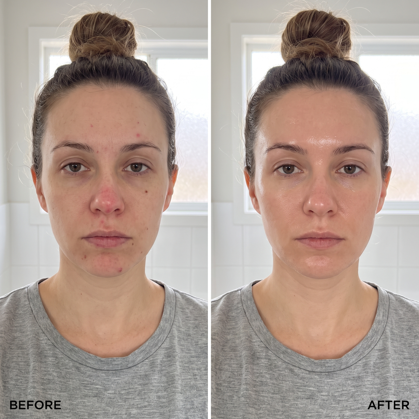 CapsuLift before and after skin results