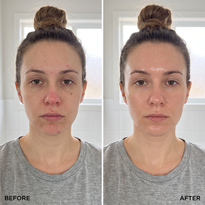 CapsuLift before and after skin results