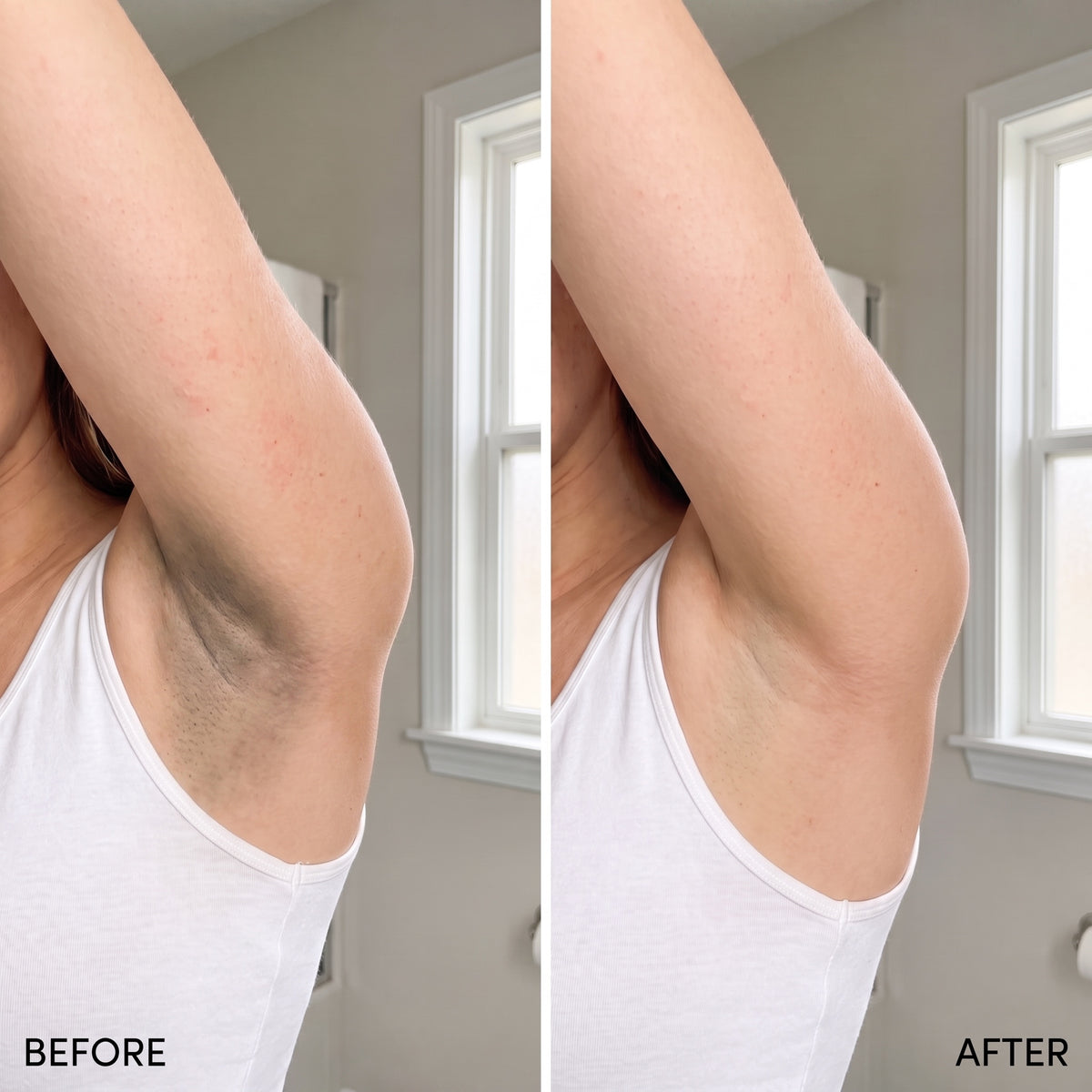 Underglow before and after underarm comparison