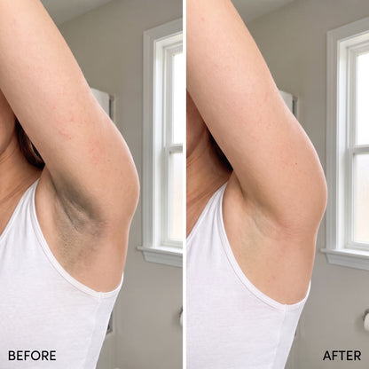 Underglow before and after underarm comparison