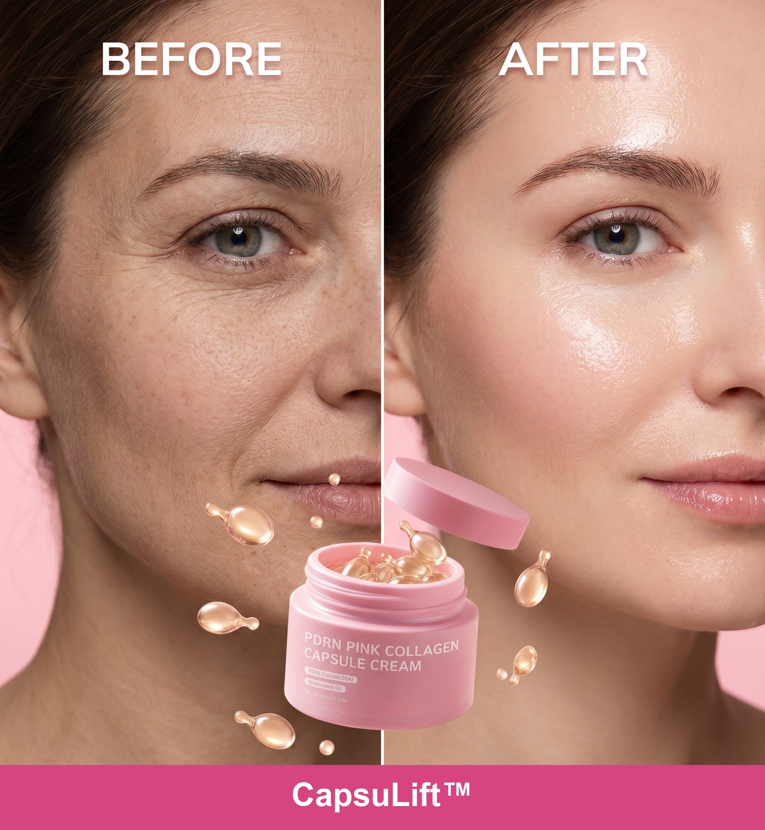 CapsuLift before and after results