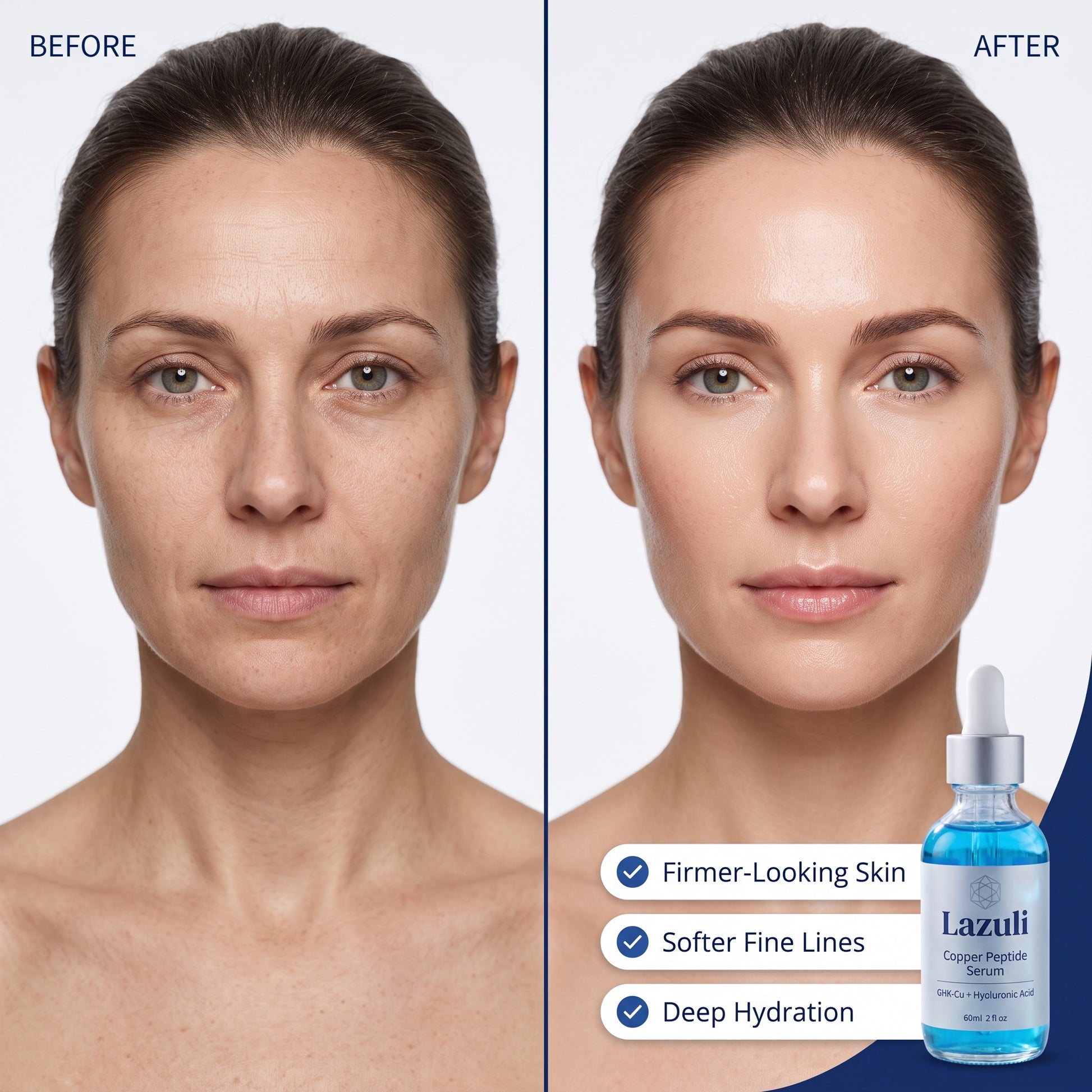 Lazuli before and after: firmer, smoother skin with softer fine lines
