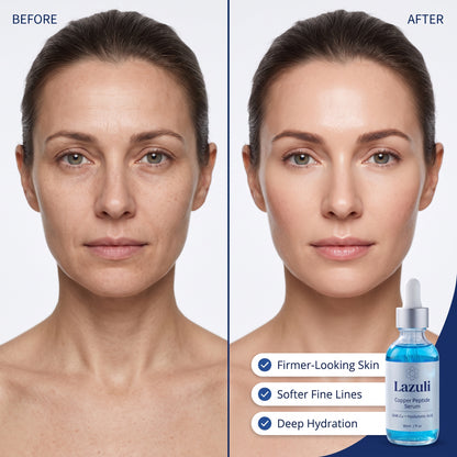 Lazuli before and after: firmer, smoother skin with softer fine lines