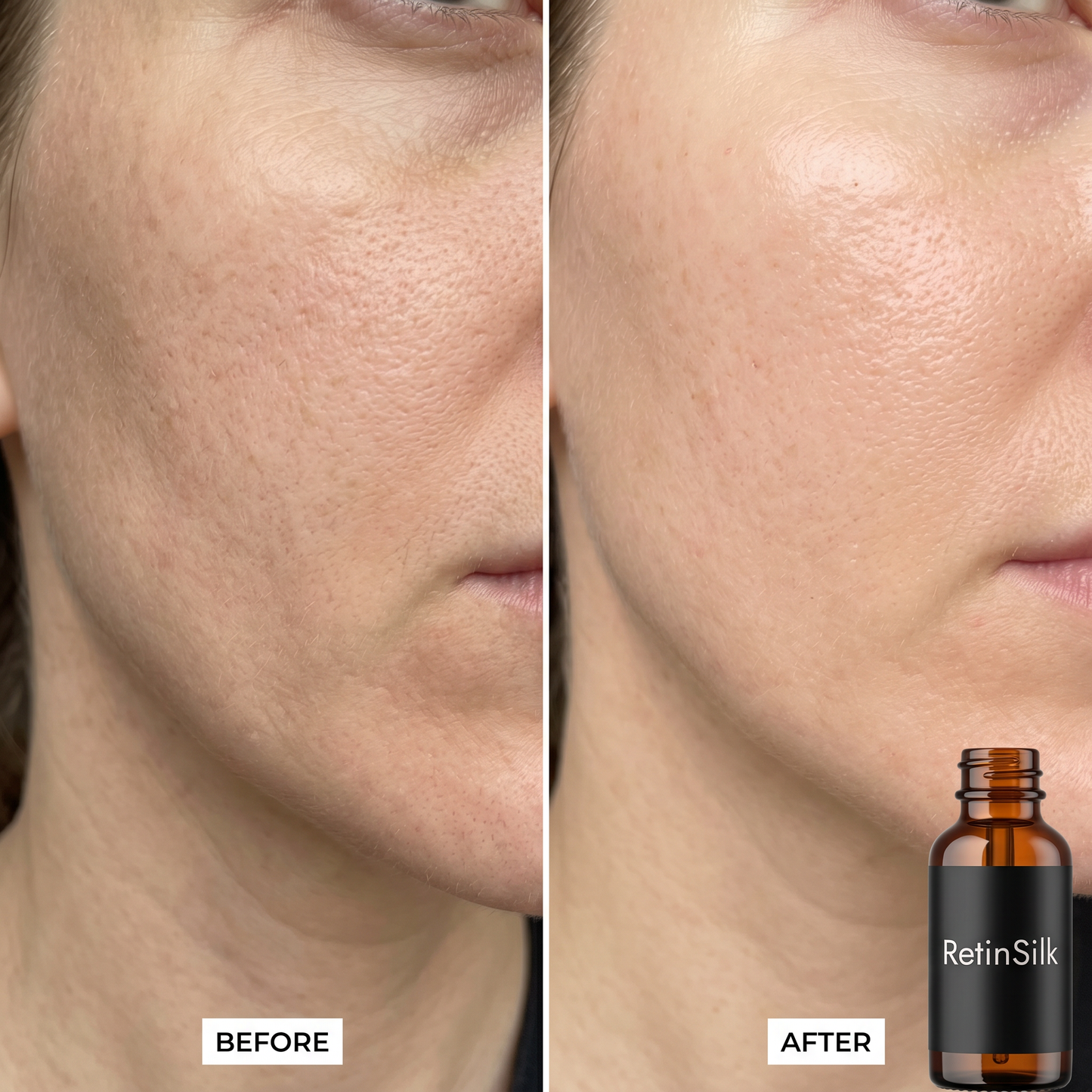 RetinSilk™ Night Resurfacing Drops