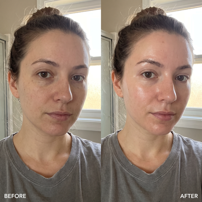 PureZing before and after brighter smoother more even skin