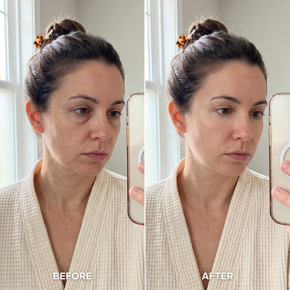 Rejuveye before and after under-eye